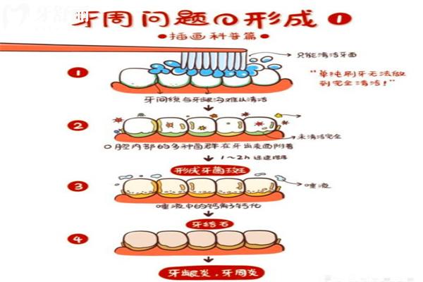 牙齦一吸就出血是怎么回事?