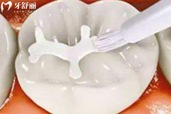 補(bǔ)牙材料樹(shù)脂有毒嗎？