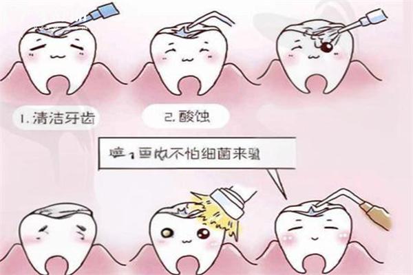 牙齒爛了個(gè)洞怎么處理
