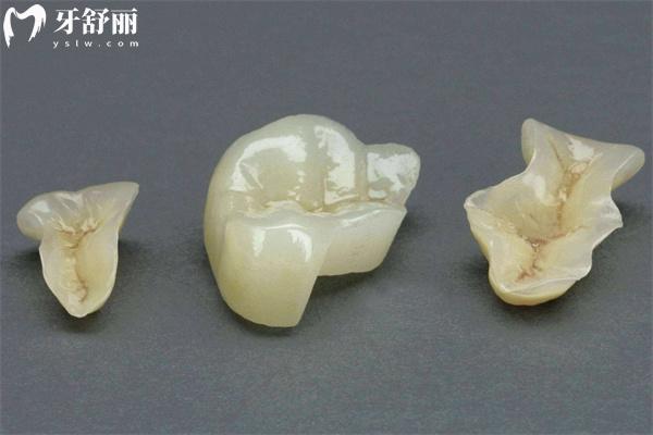嵌體補(bǔ)牙材料