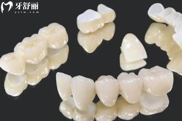 愛爾創(chuàng)全瓷牙冠質(zhì)保幾年