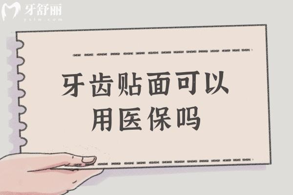 牙齒貼面可以用醫(yī) 保嗎？