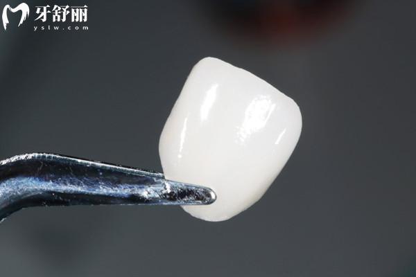 牙齒貼面可以用醫(yī) 保嗎？