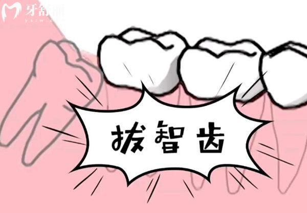 簡單智齒和復(fù)雜智齒的區(qū)別