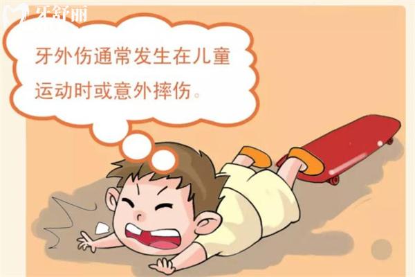 牙外傷常見的類型有哪些