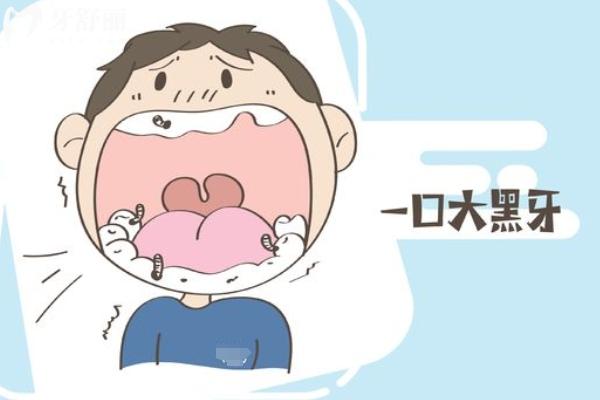 乳牙是拔掉還是自然脫落好
