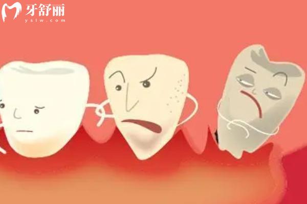 先洗牙還是先拔牙補(bǔ)牙？
