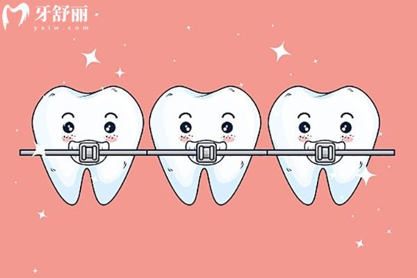 15歲矯正牙齒的利弊是什么