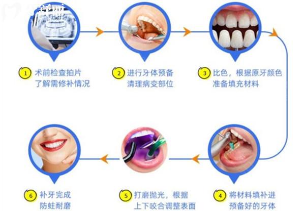 十歲孩子補牙，長大后還需要補嗎