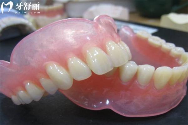 國內(nèi)常用全口義齒種類有哪些？大概多少錢一副？