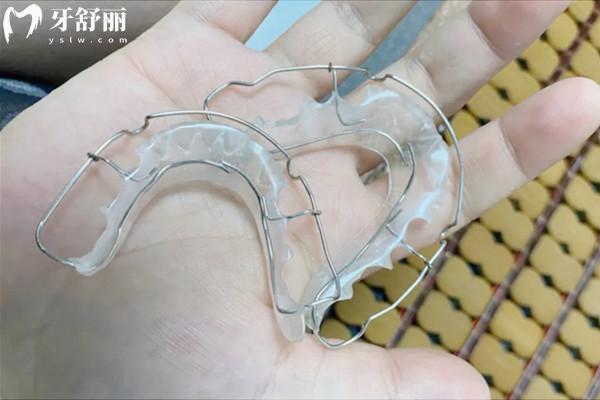 牙齒正畸保持器種類(lèi)有哪些