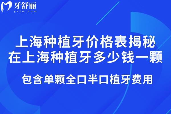 2025上海種植牙價格表揭秘在上海種植牙多少錢一顆!包含單顆全口半口植牙費用