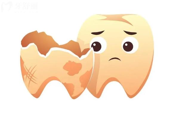 爛牙跟不拔有什么風(fēng)險(xiǎn)？可能引發(fā)一系列健康風(fēng)險(xiǎn)