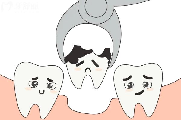 爛牙跟不拔有什么風(fēng)險(xiǎn)？可能引發(fā)一系列健康風(fēng)險(xiǎn)