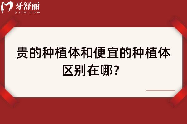 貴的種植體和便宜的種植體區(qū)別在哪？如何選擇？一文知曉