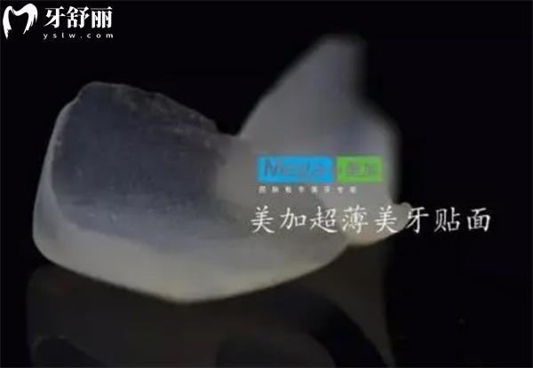 如何選擇合適厚度的全瓷貼面