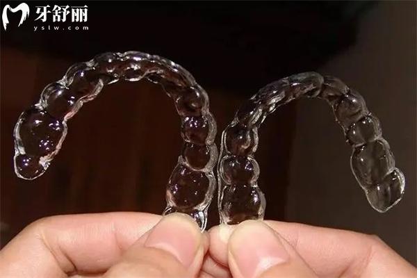 新手必看!時代天使牙齒矯正詳細全過程:佩戴順序/更換時間/復診流程
