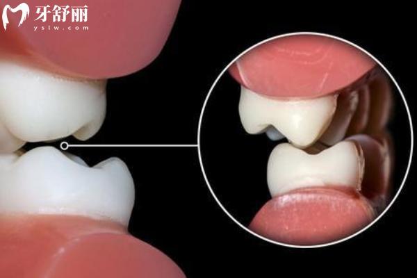 磨牙如果不治會怎么樣？