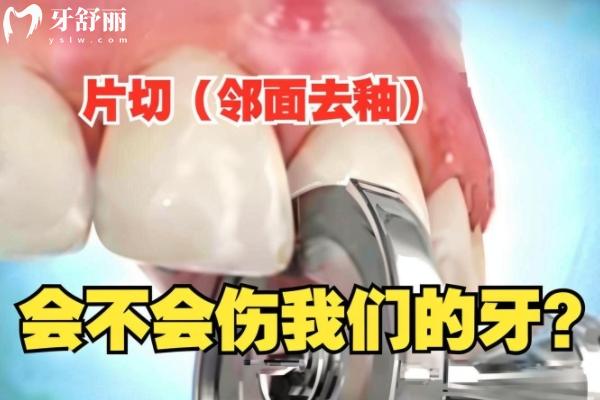 牙齒鄰面去釉對(duì)牙齒傷害大嗎？