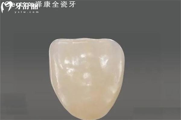 全瓷牙用多久需要更換?盤點常見品牌牙冠使用壽命多久及更換時間