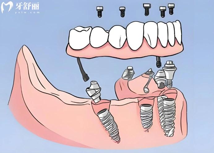 北京豐臺區(qū)牙科醫(yī)院排名榜