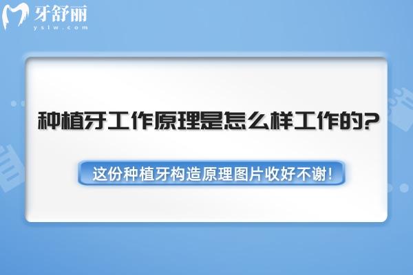 種植牙工作原理是怎么樣工作的?這份種植牙構(gòu)造原理圖片收好不謝!