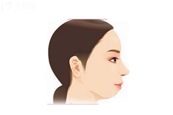 下巴后縮是什么原因？如何改善？通過(guò)矯正或日常習(xí)慣改變可改善