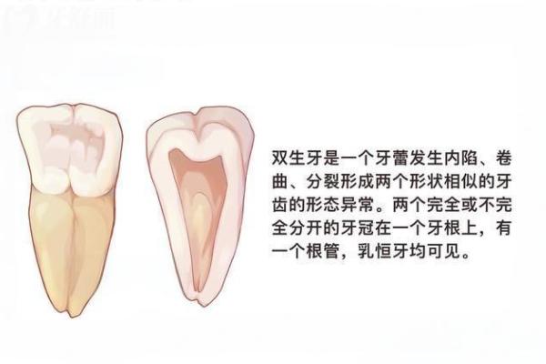 牙齒畸形.jpg