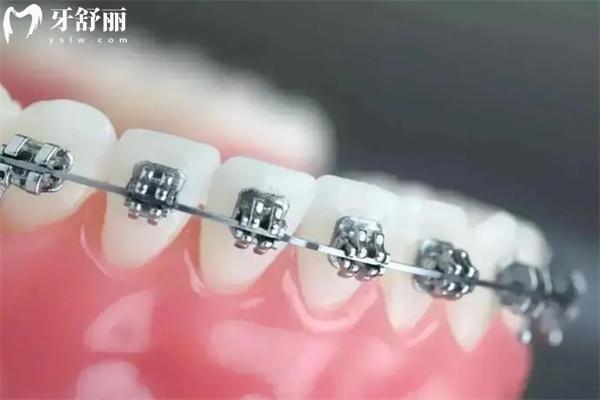 上新25版福州口腔醫(yī)院價(jià)格表:種植牙2880+牙齒矯正9800+鑲牙冠880+