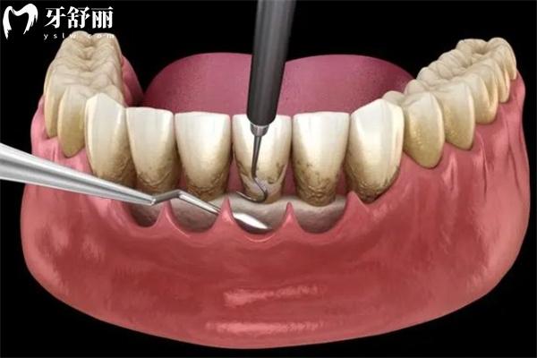 上新25版福州口腔醫(yī)院價(jià)格表:種植牙2880+牙齒矯正9800+鑲牙冠880+