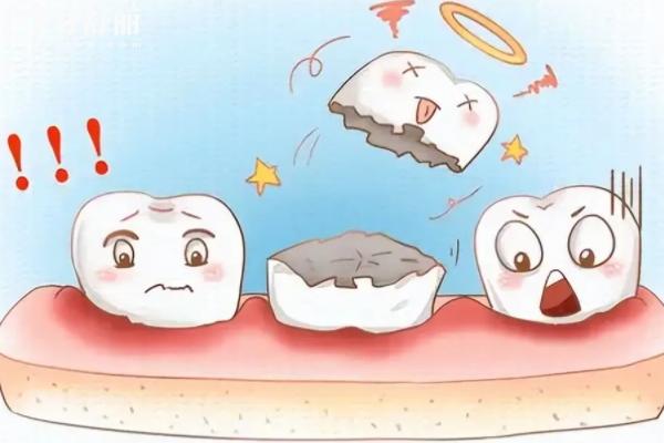 牙齒變短怎么回事