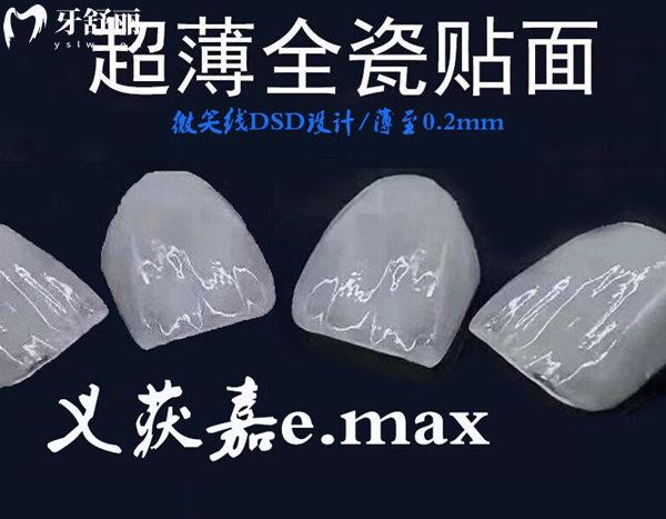 義獲嘉藍(lán)瓷牙貼面好不好？