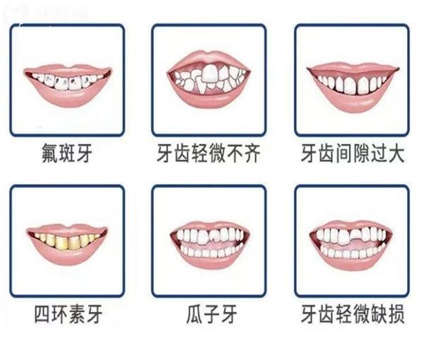 解決牙齒六大問題