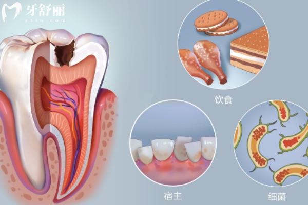 不疼不癢牙齒就沒有問題