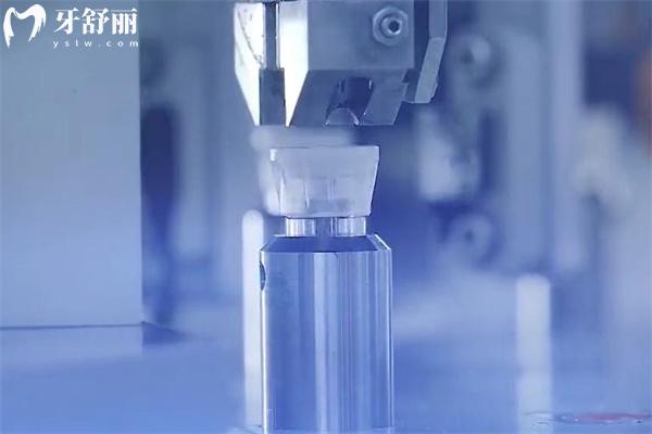 種植牙多少錢一顆2025價格表
