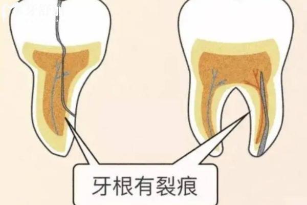 紹興上虞牙科醫(yī)院哪家好