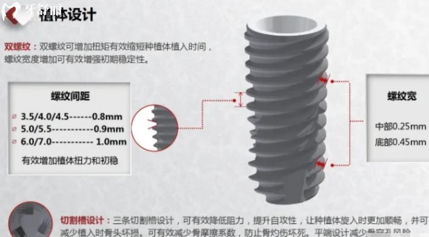 韓國十大種植體品牌排行榜及價(jià)格一文分享:包含多款韓國集采種植牙價(jià)格低至2k起
