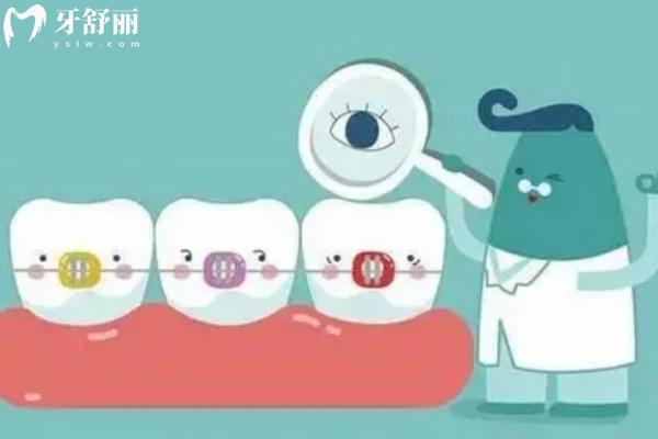 2025國內牙齒矯正收費標準是多少?揭秘鋼絲/陶瓷/隱形/兒童隱形價目表