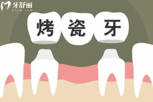 2025北京牙科醫(yī)院種牙價格表 單顆/半口/全口種植價都有附便宜又好醫(yī)院名單