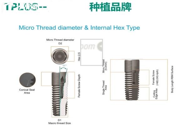 深度查詢(xún)種牙多少錢(qián)一顆2025價(jià)格表:國(guó)產(chǎn)/進(jìn)口植體收費(fèi)及半口全口費(fèi)用均有