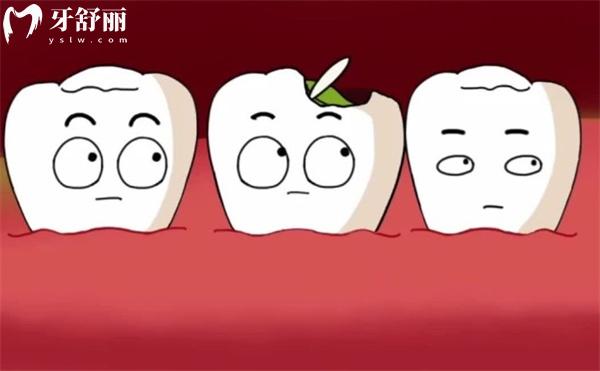 后槽牙補牙用p60和350哪個材料好？