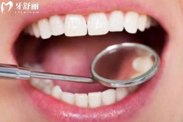 2025上海牙科醫(yī)院價格表大全 涵蓋種牙/整牙/拔牙/洗牙/兒牙附醫(yī)院名單