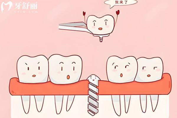 上海哪個牙科醫(yī)院口碑好便宜?尤旦/鼎植/維樂/億大資質(zhì)正規(guī)憑實(shí)力上榜