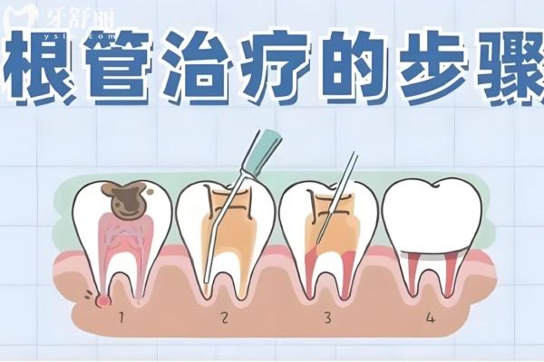 2025南京牙科醫(yī)院收費價格表查詢 揭秘正畸/種牙/兒牙/拔牙/鑲牙價格不踩雷