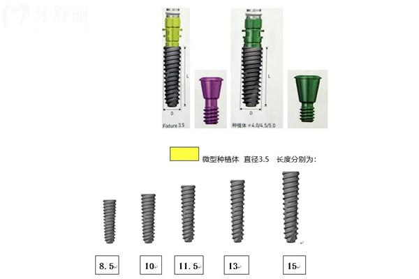 種植牙韓國(guó)登騰和奧齒泰哪個(gè)好?對(duì)比兩種植體區(qū)別可知實(shí)際質(zhì)量怎么樣?