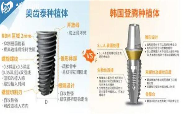 種植牙韓國(guó)登騰和奧齒泰哪個(gè)好?對(duì)比兩種植體區(qū)別可知實(shí)際質(zhì)量怎么樣?
