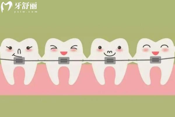 北京勁松口腔收費標準2025新版 涵蓋種植牙/矯正/補牙/拔牙/鑲牙/洗牙價格一覽表