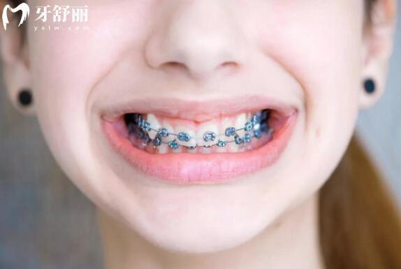 2025鹽城倍美口腔醫(yī)院看牙價(jià)格表公開:補(bǔ)牙268+