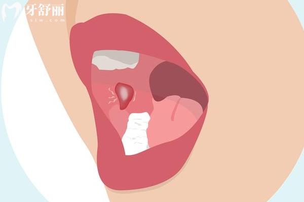 口腔常見(jiàn)疾病自測(cè)指南