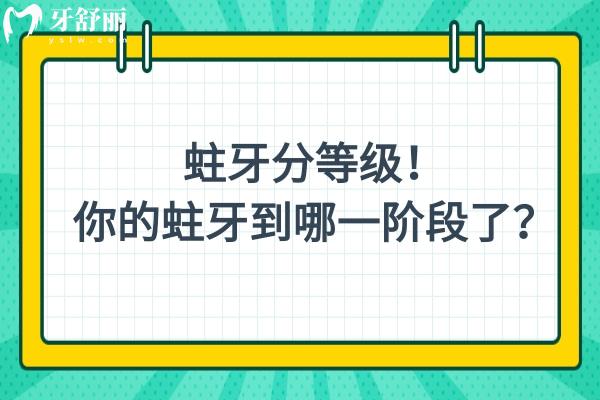 蛀牙分等級(jí)！你的蛀牙到哪一階段了？分為淺齲-中齲-深齲-牙髓炎